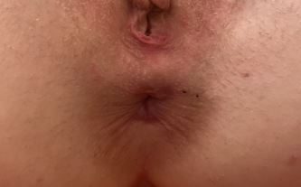 Sweetiefox Butthole