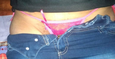 pobrezafilia mexicana 1