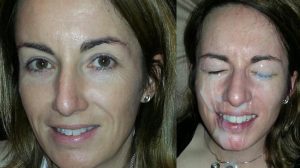 Before After Cum Facial #3